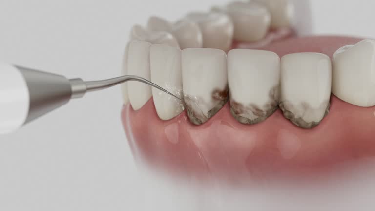 Trusted Invisalign Clear Aligners service in Idylwood, VA - Dentist Open Now